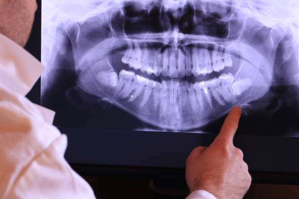 Best Emergency Root Canal Therapy in Hettinger, ND
