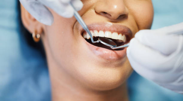 Best Emergency Wisdom Tooth Extraction in Hettinger, ND