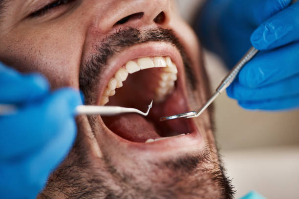Best Broken or Chipped Tooth Repair in Hettinger, ND